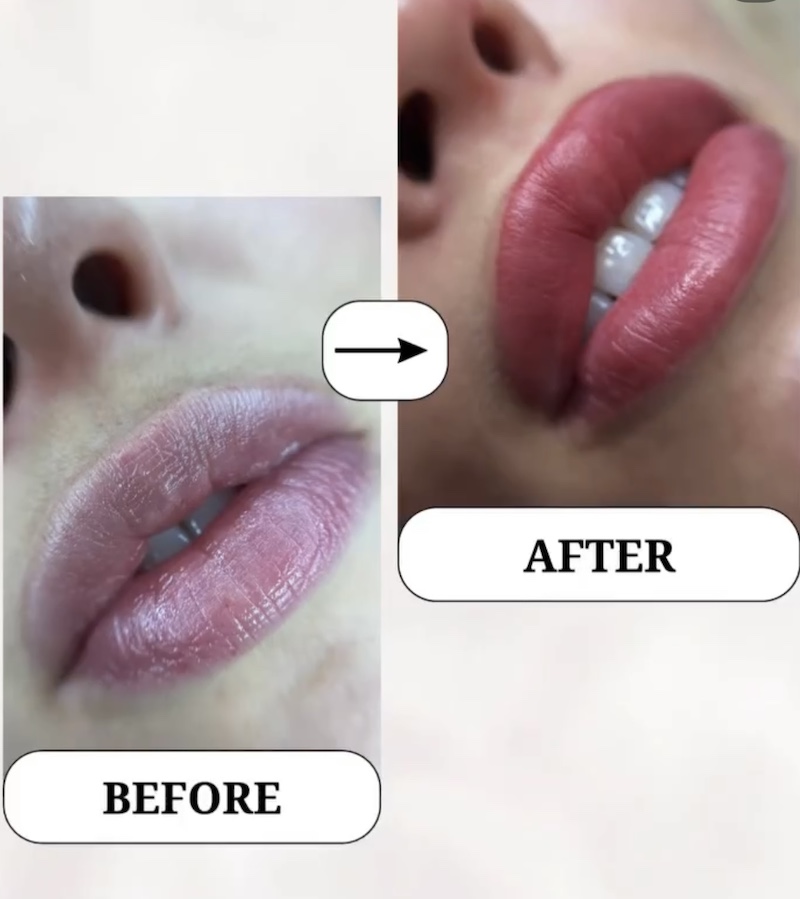 LipBlush ennen ja jälkeen BSN BEauty